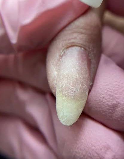 Talco para manicura